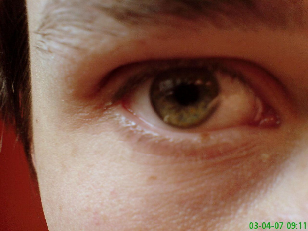 Look into My Eye #webransom